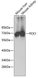 Anti-PCK1 antibody used in Western Blot (WB). GTX54629