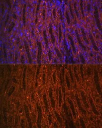 Anti-PCK1 antibody used in IHC (Paraffin sections) (IHC-P). GTX54629