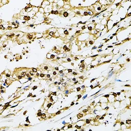 Anti-PSMB1 antibody used in IHC (Paraffin sections) (IHC-P). GTX54643