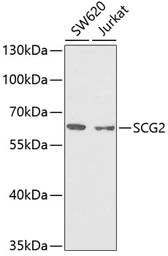 Anti-Chromogranin C antibody used in Western Blot (WB). GTX54665