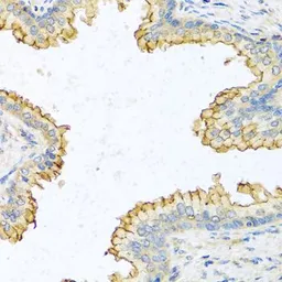 Anti-RNase 13 antibody used in IHC (Paraffin sections) (IHC-P). GTX54675