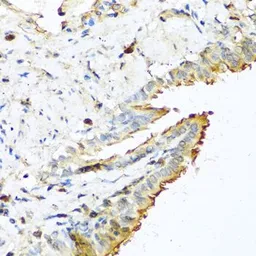 Anti-RNase 13 antibody used in IHC (Paraffin sections) (IHC-P). GTX54675
