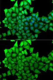 Anti-HCE antibody used in Immunocytochemistry/ Immunofluorescence (ICC/IF). GTX54686