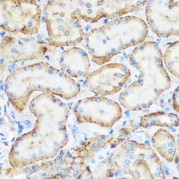 Anti-CD62E antibody used in IHC (Paraffin sections) (IHC-P). GTX54691