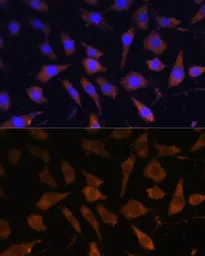 Anti-SerpinB9 antibody used in Immunocytochemistry/ Immunofluorescence (ICC/IF). GTX54693