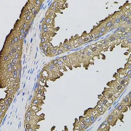 Anti-SUMO3 antibody used in IHC (Paraffin sections) (IHC-P). GTX54706