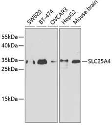 Anti-Adenine Nucleotide Translocase 1 antibody used in Western Blot (WB). GTX54715