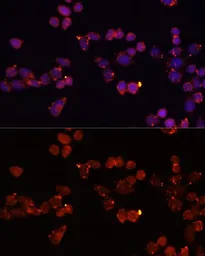 Anti-Adenine Nucleotide Translocase 1 antibody used in Immunocytochemistry/ Immunofluorescence (ICC/IF). GTX54715