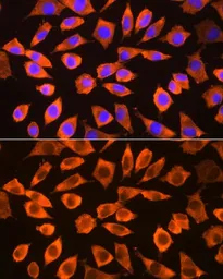 Anti-RPS3 antibody used in Immunocytochemistry/ Immunofluorescence (ICC/IF). GTX54720