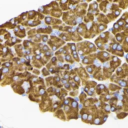 Anti-RPS3 antibody used in IHC (Paraffin sections) (IHC-P). GTX54720