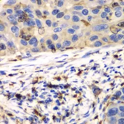 Anti-S100A8 antibody used in IHC (Paraffin sections) (IHC-P). GTX54721