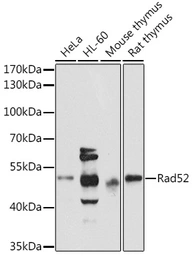 Anti-Rad52 antibody used in Western Blot (WB). GTX54722