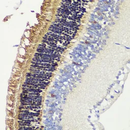 Anti-Recoverin antibody used in IHC (Paraffin sections) (IHC-P). GTX54724
