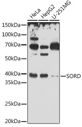 Anti-Sorbitol Dehydrogenase antibody used in Western Blot (WB). GTX54728