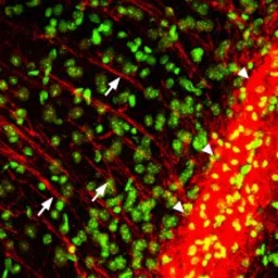 Anti-P2Y12 antibody used in IHC (Frozen sections) (IHC-Fr). GTX54796