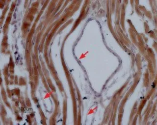 Anti-Nav1.5 antibody used in IHC (Paraffin sections) (IHC-P). GTX54803