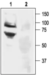 Anti-ASIC3 antibody used in Western Blot (WB). GTX54807