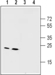 Anti-Connexin 26 antibody used in Western Blot (WB). GTX54817