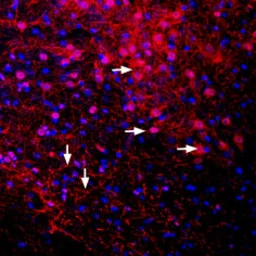 Anti-GIRK2 antibody used in IHC (Free Floating) (IHC (Free Floating)). GTX54832