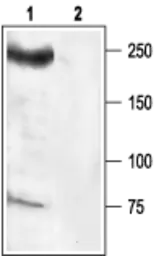 Anti-Nav1.6 antibody used in Western Blot (WB). GTX54842