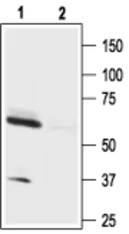 Anti-Orexin Receptor 1 antibody used in Western Blot (WB). GTX54847