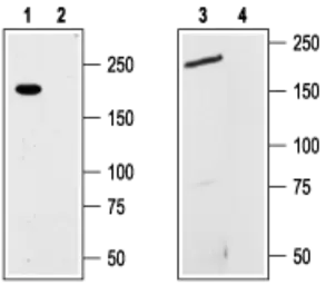 Anti-TRPM7 antibody used in Western Blot (WB). GTX54865