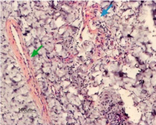 Anti-Maxi Potassium channel alpha antibody used in IHC (Paraffin sections) (IHC-P). GTX54874
