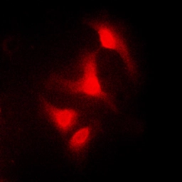 Anti-c-Abl antibody used in Immunocytochemistry/ Immunofluorescence (ICC/IF). GTX54905