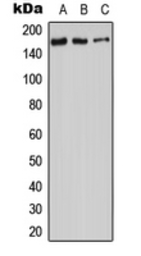 Anti-ADCY9 antibody used in Western Blot (WB). GTX54909