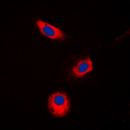 Anti-AKR1B1 antibody used in Immunocytochemistry/ Immunofluorescence (ICC/IF). GTX54911