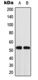 Anti-ACOT2 antibody used in Western Blot (WB). GTX54912