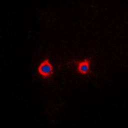 Anti-Adenosine A2a Receptor antibody used in Immunocytochemistry/ Immunofluorescence (ICC/IF). GTX54923