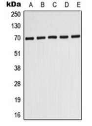 Anti-PMP70 antibody used in Western Blot (WB). GTX54937