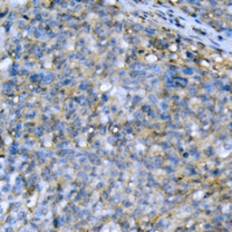 Anti-Acetyl-CoA Carboxylase 1 antibody used in IHC (Paraffin sections) (IHC-P). GTX54946