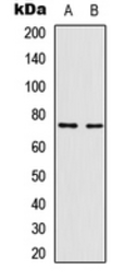 Anti-NFkB p65 (phospho Thr435) antibody used in Western Blot (WB). GTX54983