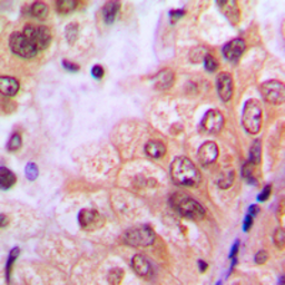 Anti-c-Abl (phospho Tyr204) antibody used in IHC (Paraffin sections) (IHC-P). GTX54998