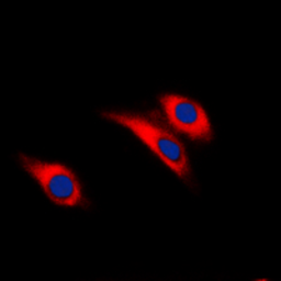 Anti-Insulin Receptor beta (phospho Tyr1322) antibody used in Immunocytochemistry/ Immunofluorescence (ICC/IF). GTX55015