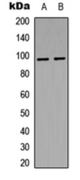 Anti-Insulin Receptor beta (phospho Tyr1322) antibody used in Western Blot (WB). GTX55015