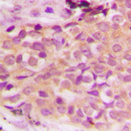 Anti-ASK1 (phospho Ser966) antibody used in IHC (Paraffin sections) (IHC-P). GTX55019