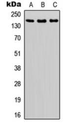 Anti-ASK1 (phospho Ser966) antibody used in Western Blot (WB). GTX55019