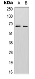 Anti-Splicing factor 1 (phospho Ser82) antibody used in Western Blot (WB). GTX55031