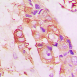 Anti-Stathmin 1 (phospho Ser25) antibody used in IHC (Paraffin sections) (IHC-P). GTX55035
