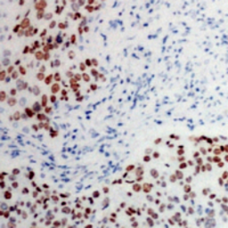 Anti-ATF2 (phospho Thr73) antibody used in IHC (Paraffin sections) (IHC-P). GTX55047