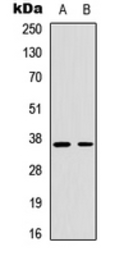 Anti-Cyclin H (phospho Thr315) antibody used in Western Blot (WB). GTX55052