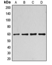Anti-Cyclin B1 (phospho Ser126) antibody used in Western Blot (WB). GTX55085