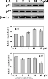 Anti-p27 Kip1 (phospho Thr198) antibody used in Western Blot (WB). GTX55090