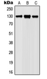 Anti-JAK1 (phospho Tyr1022) antibody used in Western Blot (WB). GTX55099