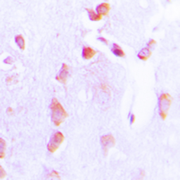 Anti-Bcl-2 (phospho Thr69) antibody used in IHC (Paraffin sections) (IHC-P). GTX55105