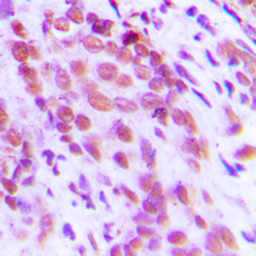 Anti-NFkB p65 (phospho Ser276) antibody used in IHC (Paraffin sections) (IHC-P). GTX55113
