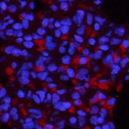 Anti-NFkB p65 (phospho Ser536) antibody used in IHC (Paraffin sections) (IHC-P). GTX55114